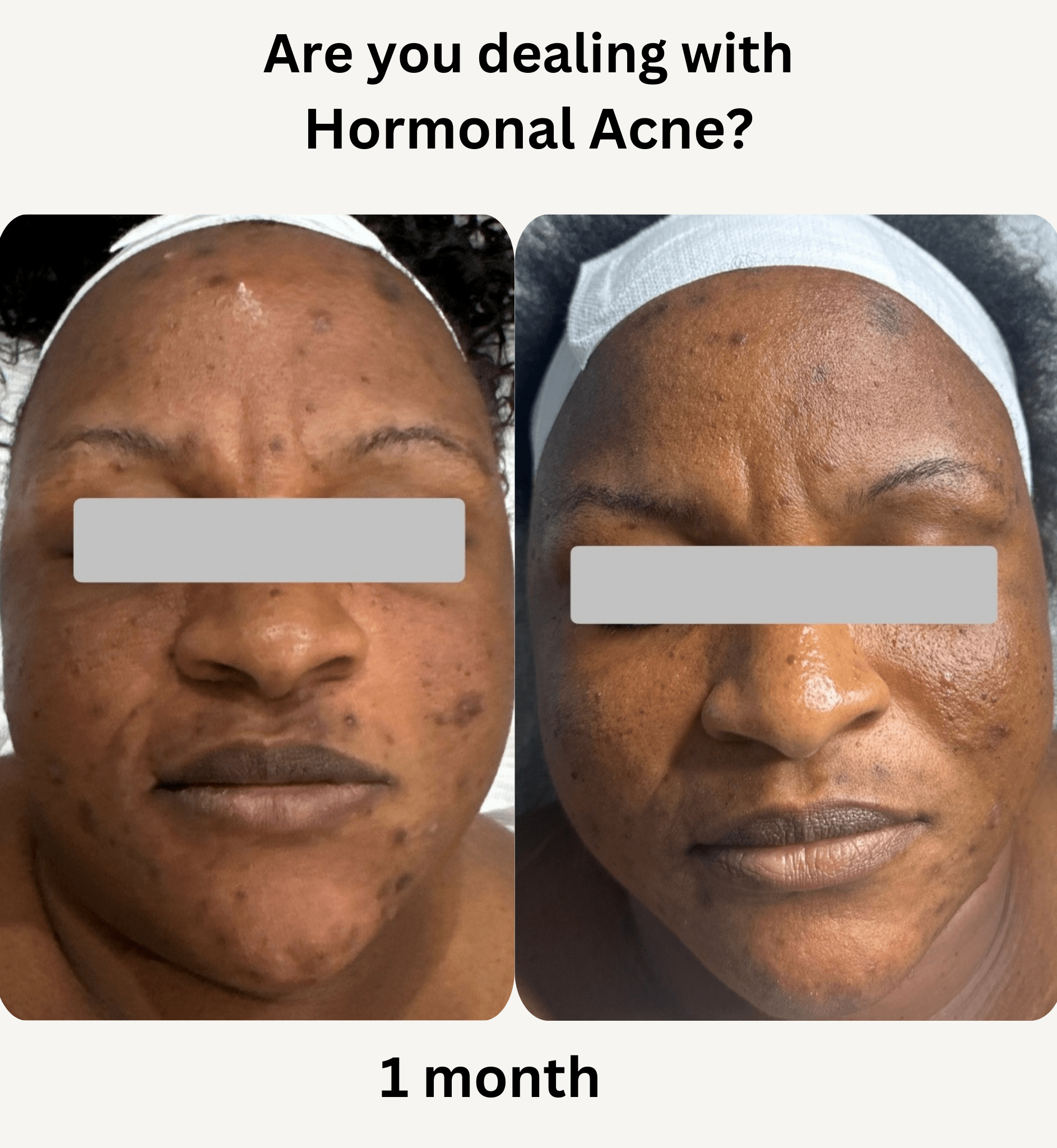 KOREAN TREATMENT -min